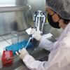 Türk bilim insanlarından ‘Alzheimer' riskini ölçen kit