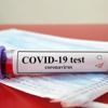 Covid-19 ile ilgili testlerin güvenilirliği konusunda sağlıkçılarda ciddi endişeler var: Yazı tura atsanız daha iyi