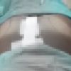 Brezilya kalçası istedi ölümden döndü. İstanbul sosyetesi ünlü doktoru konuşuyor. Estetik ameliyat olacaklar bir kez daha düşünsün