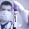 Covid-19 testi pozitif çıkan kişi, doğum günü partisinde yakalandı