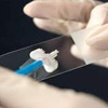 Smear Testi Nedir Smear Testi Nedir