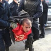 Ankara'daki polis müdahalesi hastanelik etti Ankara'daki polis müdahalesi hastanelik etti