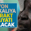 1 milyon Afrikalıya katarakt ameliyatı yapılacak
