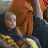 Kamerun'da kolera salgını nedeniyle 4 kişi öldü