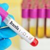 Brusella hastalığı nedir? Belirtileri nelerdir? Tedavisi var mıdır? Brusella hastalığı nedir? Belirtileri nelerdir? Tedavisi var mıdır?