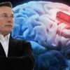 Elon Musk'ın yeni çılgın projesi: İnsan beynine çip takacak Elon Musk'ın yeni çılgın projesi: İnsan beynine çip takacak