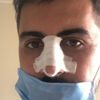 "Sosyal mesafe" dedi! Burnunu kırdılar! "Sosyal mesafe" dedi! Burnunu kırdılar!