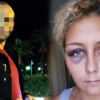 Eski sevgili gözaltına alındı Eski sevgili gözaltına alındı