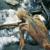 Buzadam Ötzi ülser hastasıymış Buzadam Ötzi ülser hastasıymış