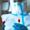 Özel hastaneler için yeni ödeme modeli: PCR testi sonucu pozitif çıkan hastanın tedavisi için devletten ödenek alınabilecek Özel hastaneler için yeni ödeme modeli: PCR testi sonucu pozitif çıkan hastanın tedavisi için devletten ödenek alınabilecek