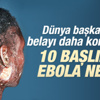 Madde madde ölümcül Ebola virüsü Madde madde ölümcül Ebola virüsü