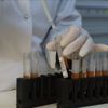 HIV'de 'dışlanma' teşhis ve tedaviyi engelliyor HIV'de 'dışlanma' teşhis ve tedaviyi engelliyor