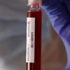 Almanya'da koronavirüs bilançosu ağırlaşıyor