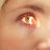 Diyabetik retinopati kör yapabilir Diyabetik retinopati kör yapabilir