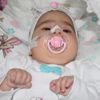 SMA teşhisi konulan 6 aylık Elif, yaşamını 5 tıbbi ... SMA teşhisi konulan 6 aylık Elif, yaşamını 5 tıbbi ...