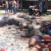Şanlıurfa Suruç'ta patlama