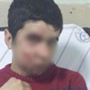 Gaz kapsülü değil taş yaralamış Gaz kapsülü değil taş yaralamış