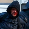 Blockupy sözcüsü: Polis bize acımadı! Blockupy sözcüsü: Polis bize acımadı!