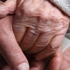 Alzheimer alanında büyük gelişme Alzheimer alanında büyük gelişme