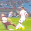 Bacağında 2 cm. delik var