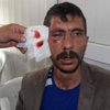 HDP'li müşahid darp edildi ! HDP'li müşahid darp edildi !