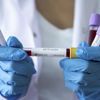 Rusya'da koronavirüse karşı 11 adet ilaç geliştirildiği açıklandı