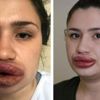 Sahte estetikçinin cezası belli oldu
