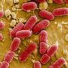 Yapay zeka sayesinde en tehlikeli bakterileri öldüren antibiyotik bulundu