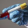Avustralya'da koronavirüs bilançosu artıyor: Ölü sayısı 13, vaka sayısı 3 bini geçti