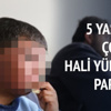 Savaşın izini yüzünde taşıyor