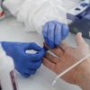 Kan testiyle Alzheimer 4 sene önceden tahmin ediliyor Kan testiyle Alzheimer 4 sene önceden tahmin ediliyor
