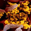 Hollanda'da koronavirüsten ölenlerin sayısı 276'ya yükseldi
