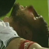 Tomas Sivok sakatlanarak oyundan çıkmak zorunda kaldı