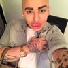Kim Kardashian'a benzemek istedi ama...