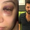 1 aydır evden çıkamıyorum