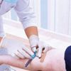 Damardan ömür testi Damardan ömür testi
