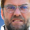Jürgen Klopp, bugün yarın...