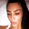 Kim Kardashian sedef hastası