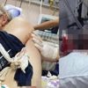 İnşaat işçisinin vücuduna saplanan demir çıkarıldı İnşaat işçisinin vücuduna saplanan demir çıkarıldı