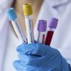 Lancet: Covid geçirenler yeniden enfekte olabilir