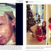Katie Piper'in yeni yüzü Katie Piper'in yeni yüzü
