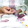 ‘Parmak bebek’ hayata tutundu ‘Parmak bebek’ hayata tutundu
