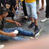 Piknik tüpü yüzüne patladı Piknik tüpü yüzüne patladı