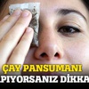 Çayla göz pansumanına dikkat!