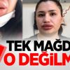 Bir slikon rezaleti daha! Tek mağdur o değilmiş!