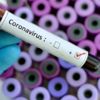 Sudan'da koronavirüs nedeniyle ilk ölüm gerçekleşti
