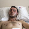Patlamada yaralanan genç o anları anlattı Patlamada yaralanan genç o anları anlattı