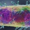 Yersinia pestis nedir Yersinia pestis nedir