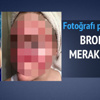 Cilt kanserine yakalanan solaryum bağımlısı