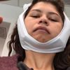 Zendaya'nın ameliyat sonrası paylaşımları şaşırttı Zendaya'nın ameliyat sonrası paylaşımları şaşırttı
